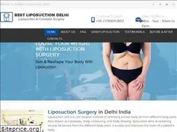 Sites similar to bestliposuctiondelhi.com