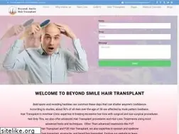 Sites similar to beyondsmilehairtransplant.com