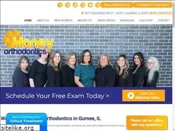 Sites similar to bitesnkites.com