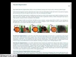 Sites similar to blackrockvision.com