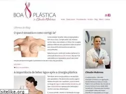 Sites similar to boaplastica.com.br