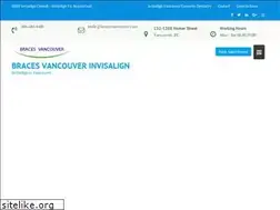 Sites similar to bracesvancouver.com