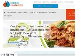 Sites similar to brandwonden.be