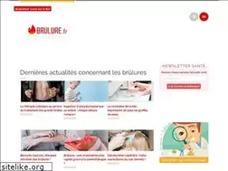 Sites similar to brulure.fr
