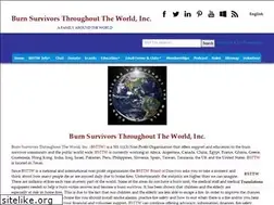 Sites similar to burnsurvivorsttw.org