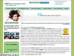 Sites similar to byebyebaldness.com