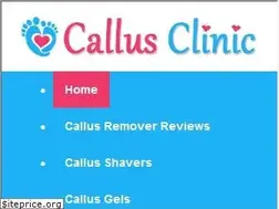 Sites similar to callusremovalguide.com