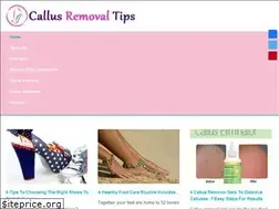 Sites similar to callusremovaltips.com