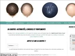 Sites similar to calvitie-conseil.com