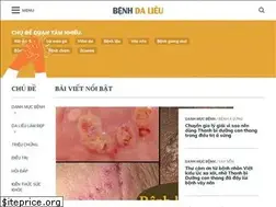 Sites similar to camnangbenhdalieu.com