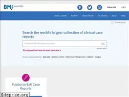 Sites similar to casereports.bmj.com