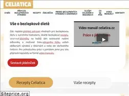 Sites similar to celiatica.cz