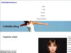 Sites similar to cellulitisbehandeling.eu