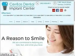 Sites similar to cerritosimplant.com