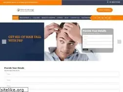 Sites similar to chandigarhhairtransplantation.com
