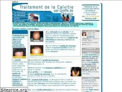 Sites similar to chirurgie-esthetique-cheveux.com