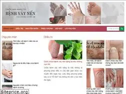 Sites similar to chuatribenhvaynen.com