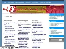 Sites similar to cievy.sk