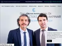 Sites similar to civashairtransplant.com