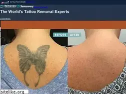 Sites similar to cleanslatelaser.com