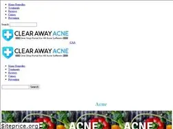 Sites similar to clearawayacne.com