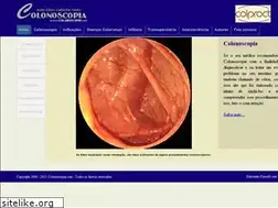 Sites similar to colonoscopia.com