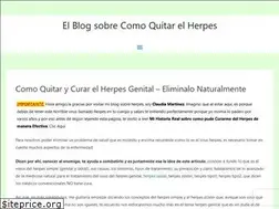 Sites similar to comoquitarelherpes.com