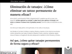 Sites similar to comoquitartatuajes.com
