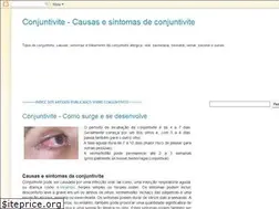 Sites similar to conjuntivite-alergica.blogspot.com