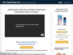 Sites similar to curetoenailfungusfast.com