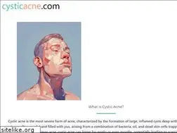 Sites similar to cysticacne.com