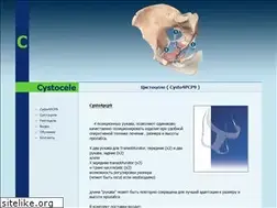 Sites similar to cystocele.ru