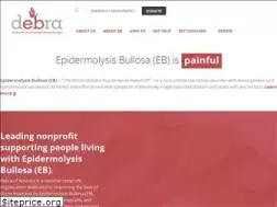 Sites similar to debra.org