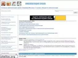 Sites similar to dental-implant.ru