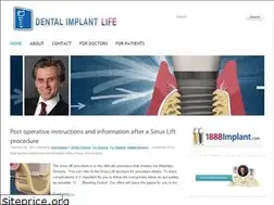 Sites similar to dentalimplantlife.com