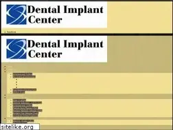 Sites similar to dentalimplantmi.com