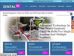 Sites similar to dentalimplantsclinicindia.com