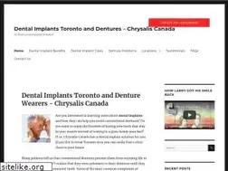 Sites similar to dentalimplantstoronto.info