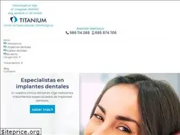 Sites similar to dentaltitanium.com