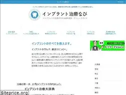 Sites similar to dentist-implant.com