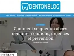 Sites similar to dentonblog.fr