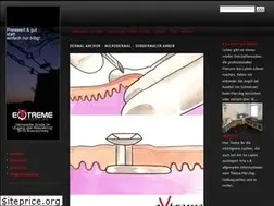 Sites similar to dermalanchor.extremepiercing.de