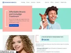 Sites similar to diamondbraces.com