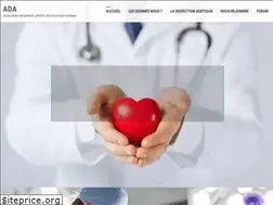 Sites similar to dissectionaortique.fr