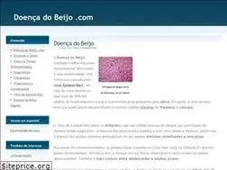 Sites similar to doencadobeijo.com