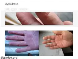 Sites similar to dyshidrosis.co.uk