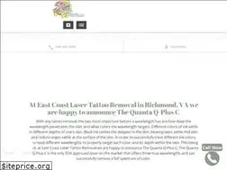 Sites similar to eastcoastlasertattooremoval.com