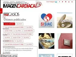 Sites similar to ecocardio.com