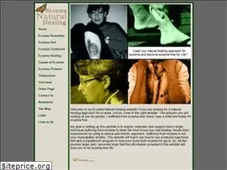 Sites similar to eczema-natural-healing.com