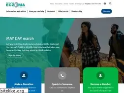 Sites similar to eczema.org